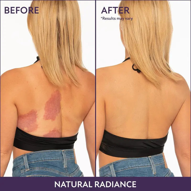 Euophora™ Beauty Coverage Perfector