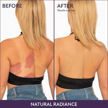 Euophora™ Beauty Coverage Perfector